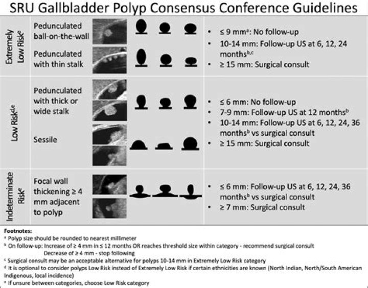 How many mm is considered a large polyp?