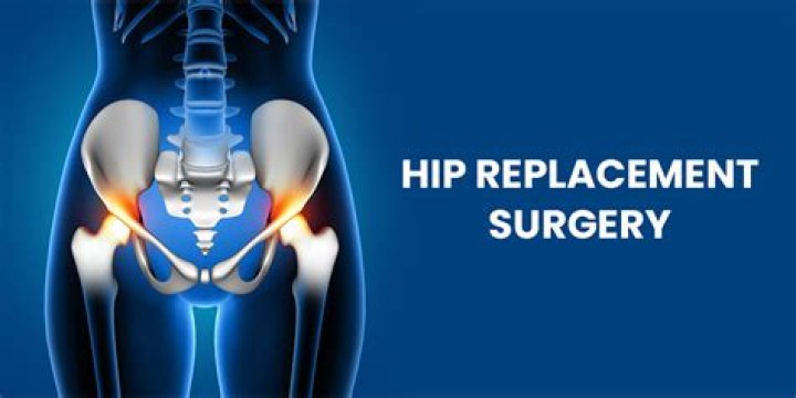 How many people need hip implants?