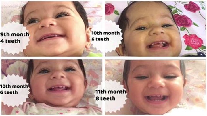 How many teeth should 9 month old have?