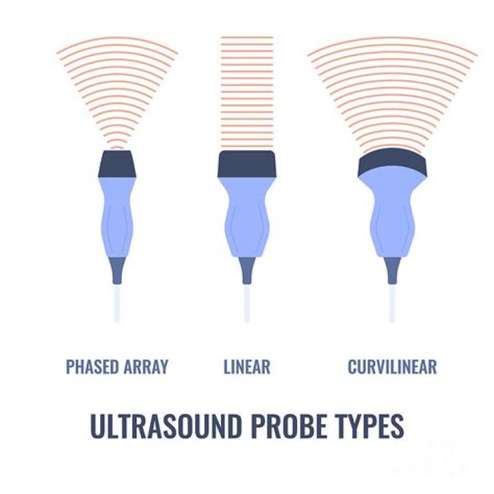 How many types of Doppler ultrasound are there?
