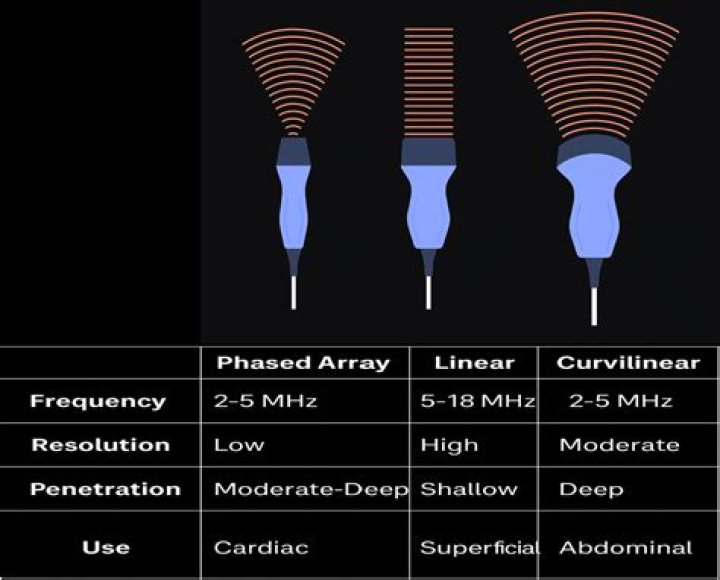 How many types of ultrasound probes are there?