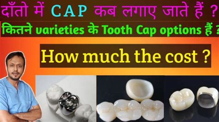 How much do caps cost per tooth?