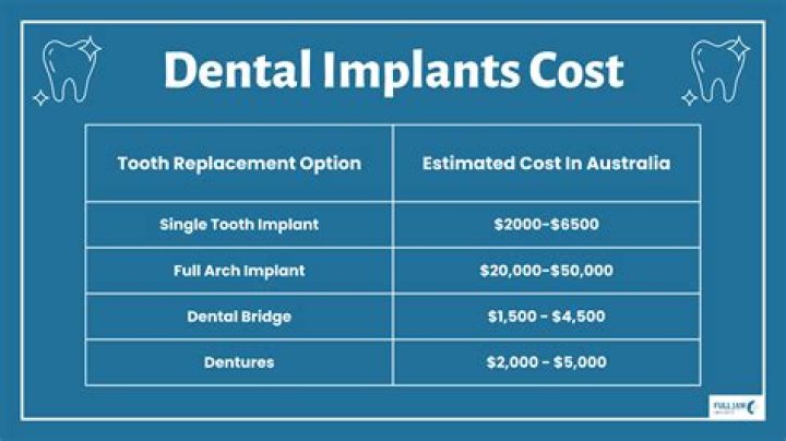 How much do front teeth implants cost?