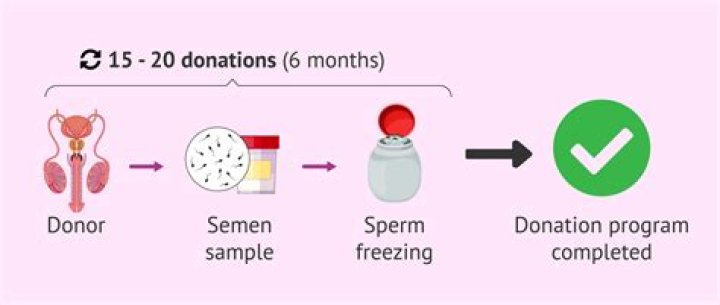How much does it cost to get inseminated with a sperm donor?