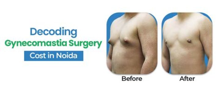 How much does it cost to get rid of male breast?