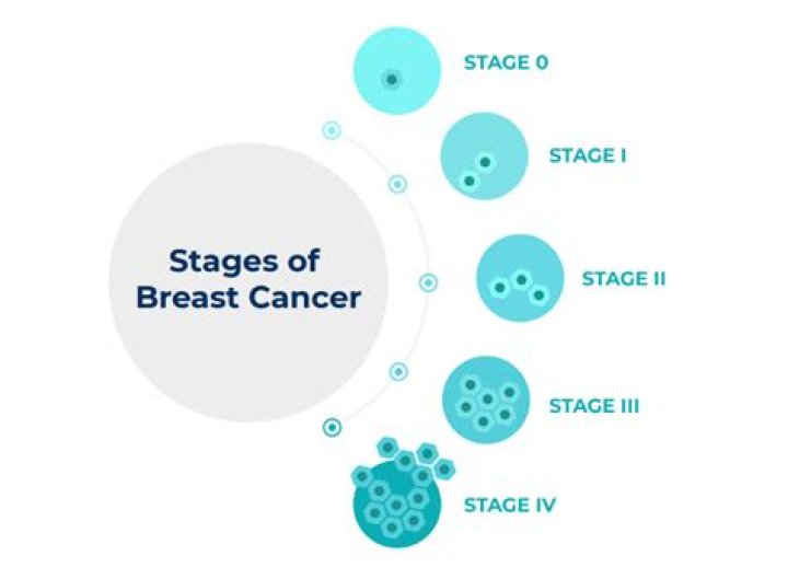 How much does it cost to operate breast cancer?