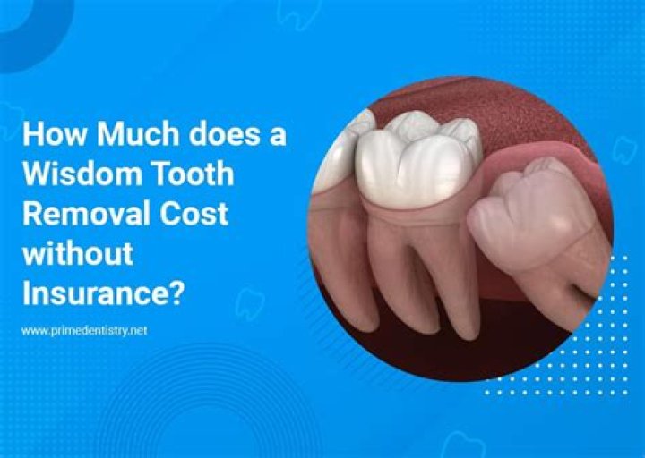 How much does Prizmo cost?