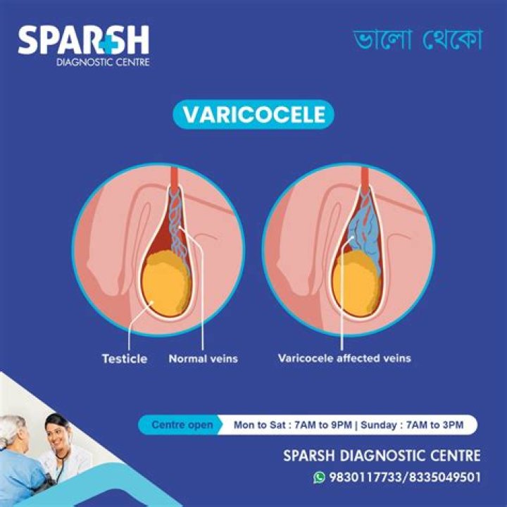 How much does varicocele treatment cost?