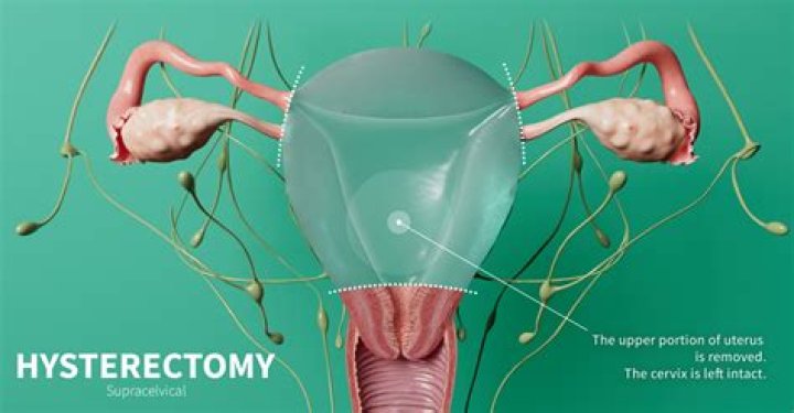 How much rest is required after laparoscopic hysterectomy?
