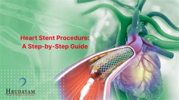 How serious is a heart stent procedure?