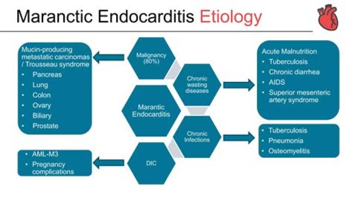 How to treat marantic endocarditis?