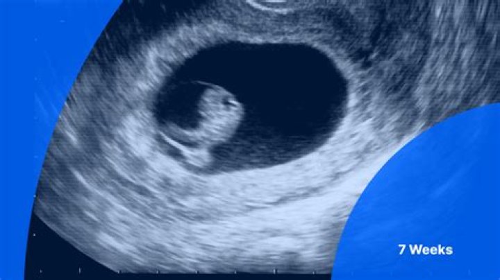 Is 8 weeks a wonder week?