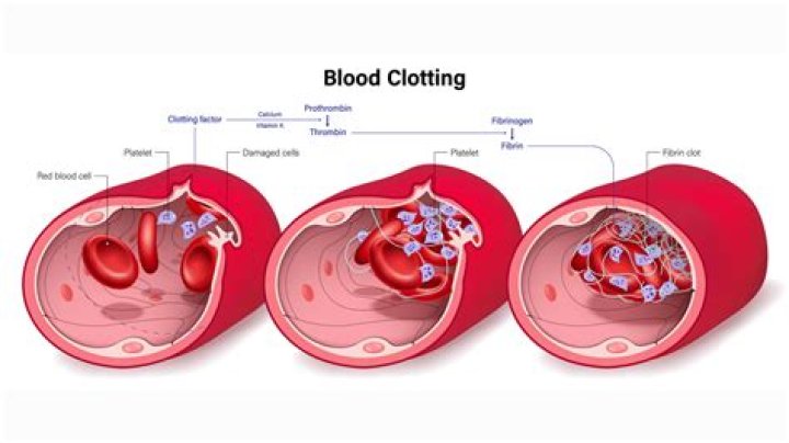 Is a factor related to blood clotting?