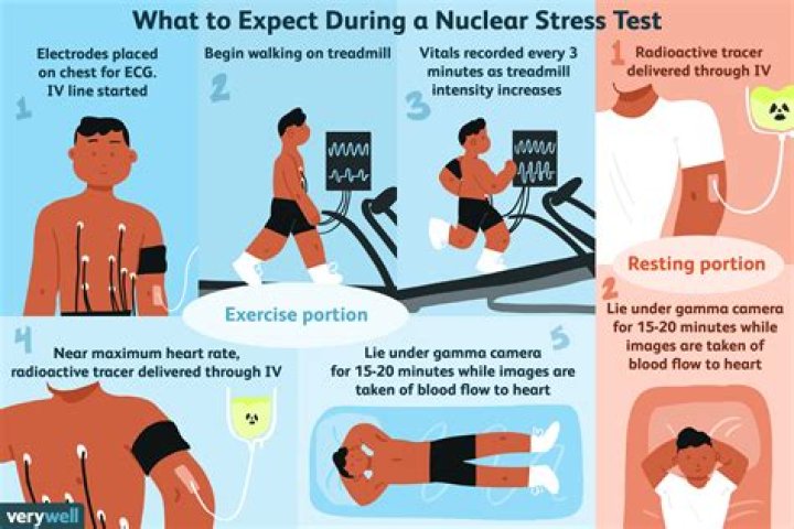 Is a lexiscan the same as a nuclear stress test?