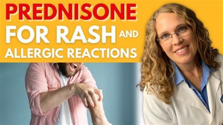 Is aggression a side effect of prednisone?