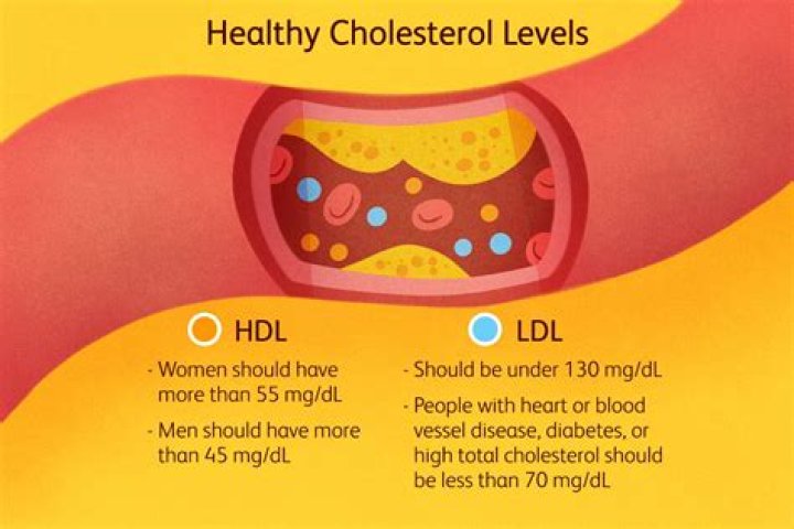 Is an LDL of 101 bad?