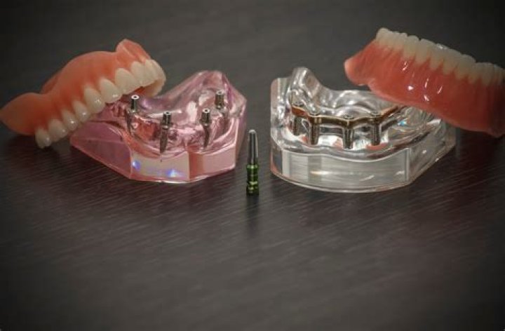 Is Costa Rica safe for dental implants?