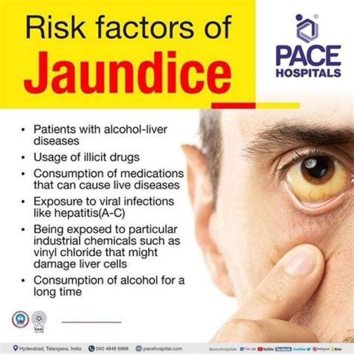 Is fatigue a symptom of jaundice?