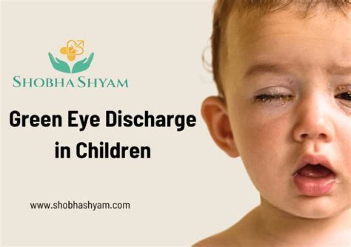Is green eye discharge normal?