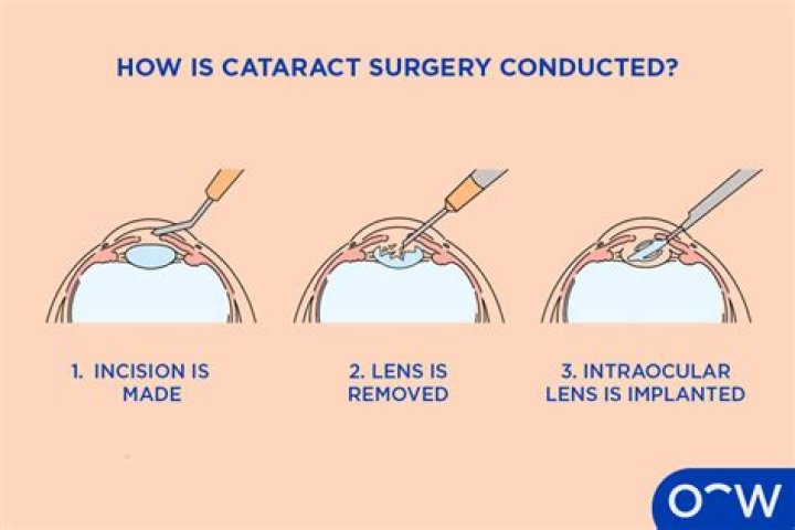 Is it normal to have blood in your eye after cataract surgery?