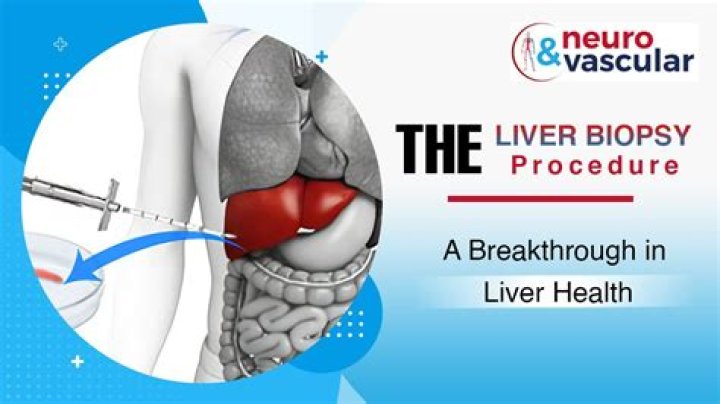 Is liver biopsy necessary for hepatitis B?