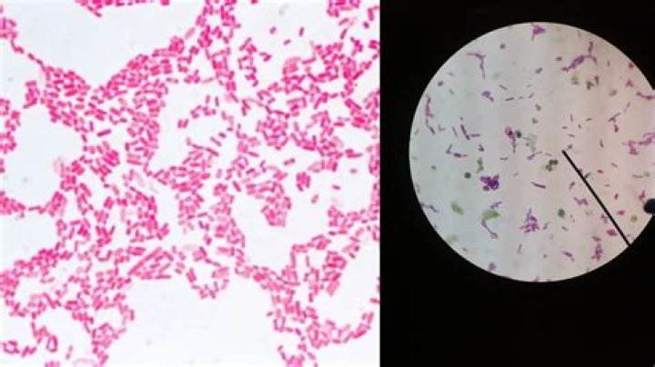 Is methylobacterium gram negative?