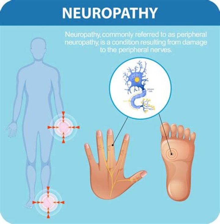 Is neuropathy common in alcoholics?
