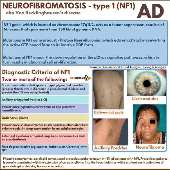 Is NF1 a cancer?