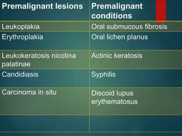 Is Oral Lichen Planus premalignant condition?