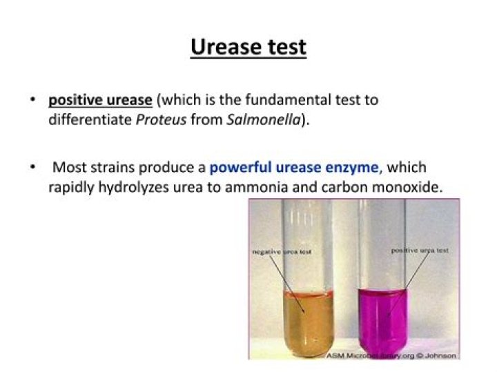 Is Salmonella urease positive or negative?