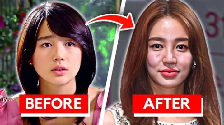 Is Thailand known for plastic surgery?