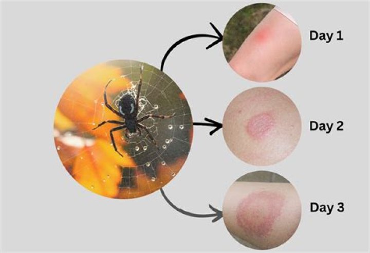 Is the Hacklemesh Weaver poisonous?