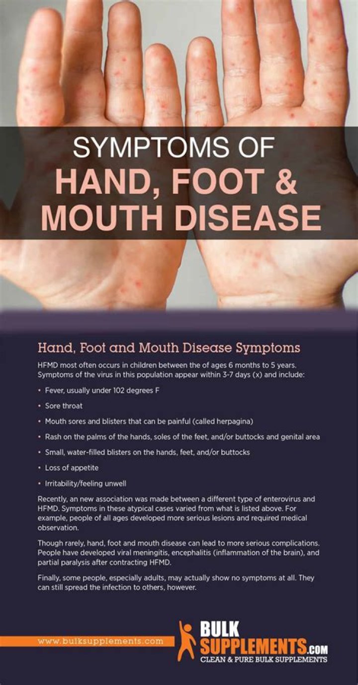 Is there an outbreak of hand foot and mouth disease?