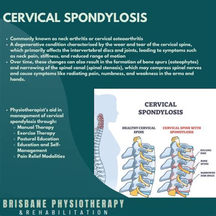 Is traction good for cervical spondylosis?