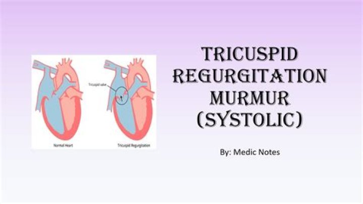 Is tricuspid regurgitation a systolic murmur?