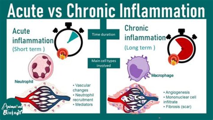Is UTI chronic or acute?