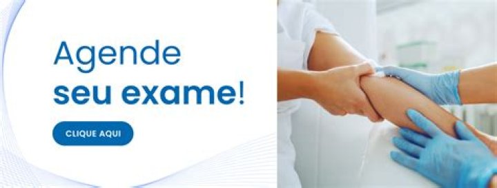 O que altera o exame de TSH?