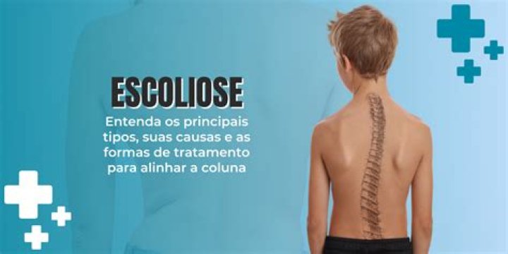 Por que a escoliose pode causar problemas na coluna?