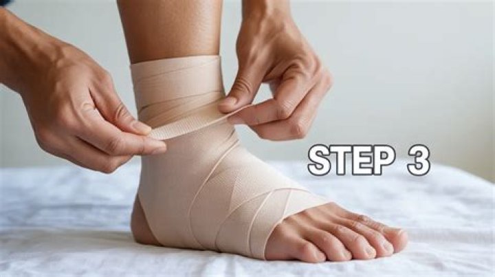 Should a sprained ankle be wrapped?