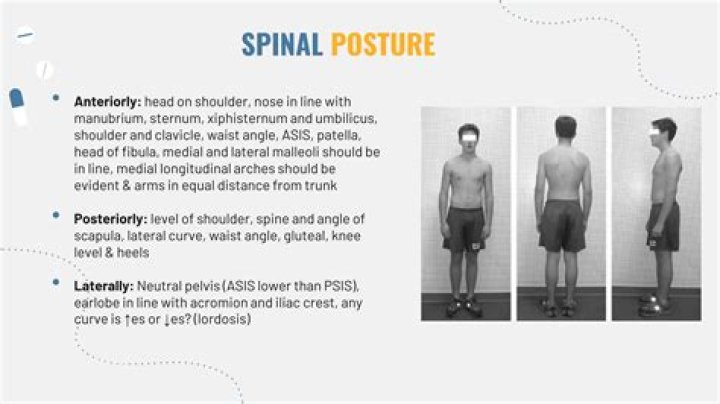 Should PSIS and ASIS be level?