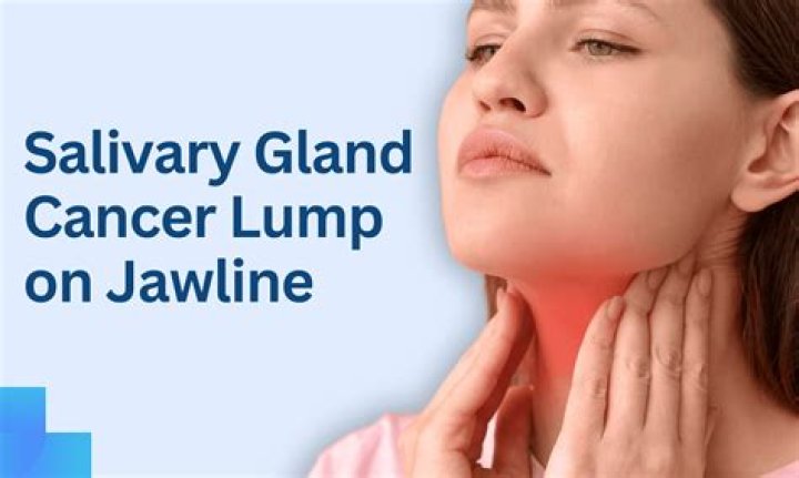 Should you be able to feel your glands under your jaw?