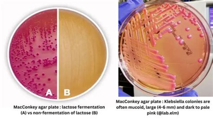 Siapa koloni Shigella dysenteriae?