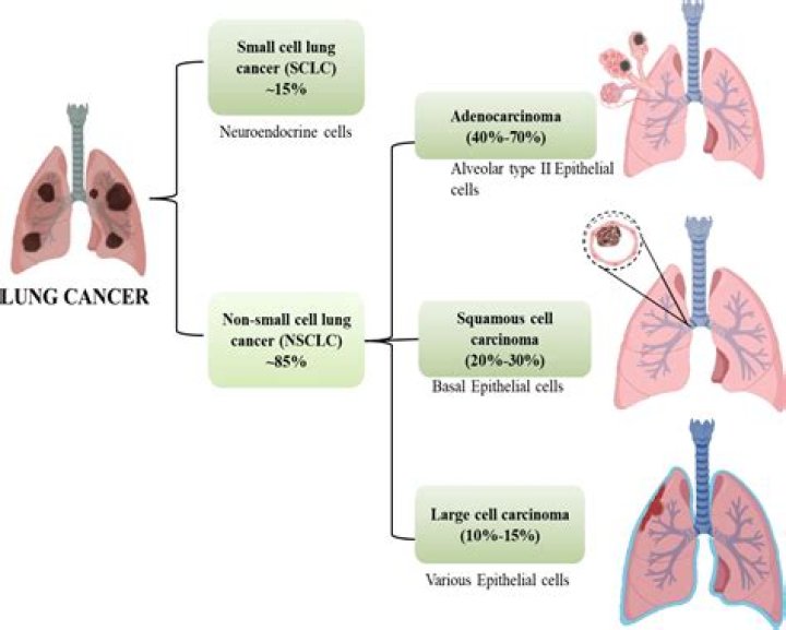 Wat is een longcarcinoom?