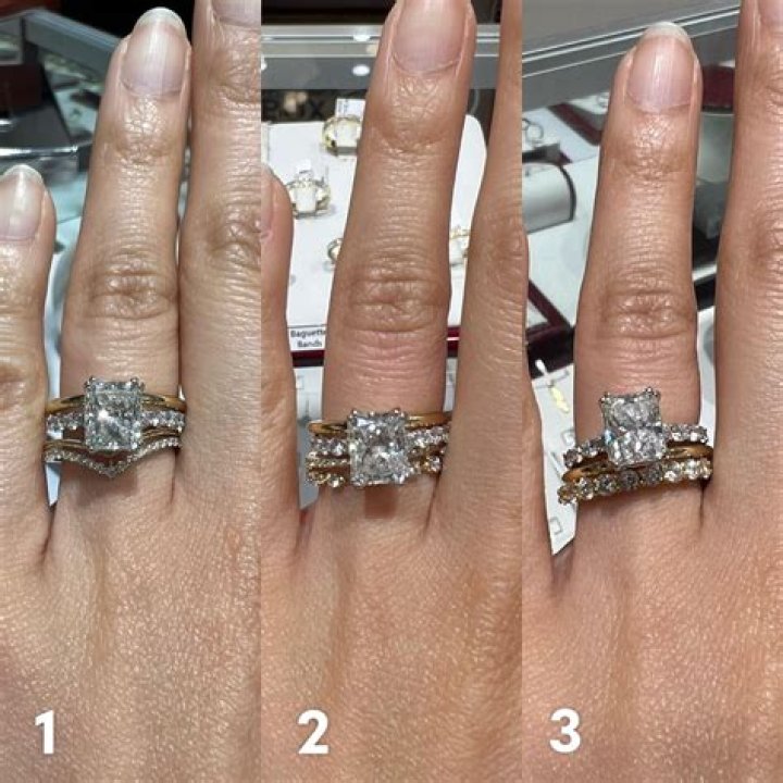 What are Cord rings?