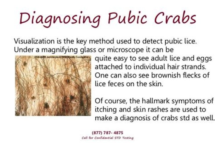 What are crabs STDs?