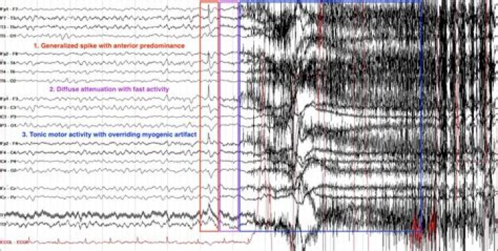 What are EEG scans used for psychology?