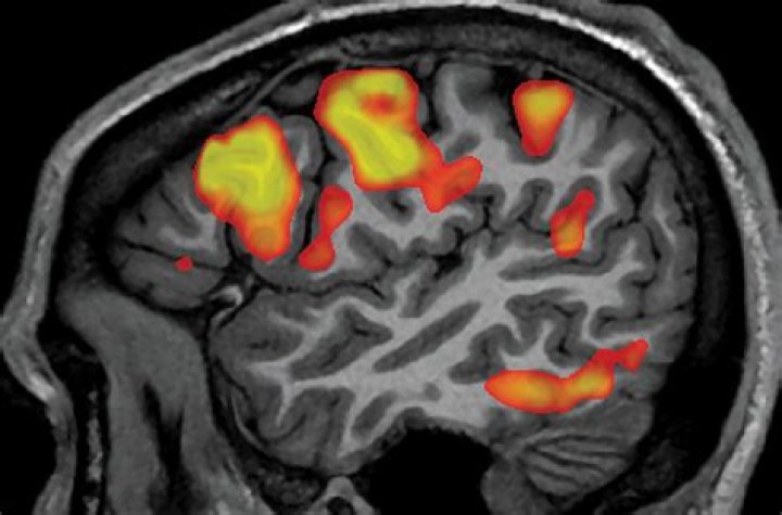 What are fMRI scans used for psychology?