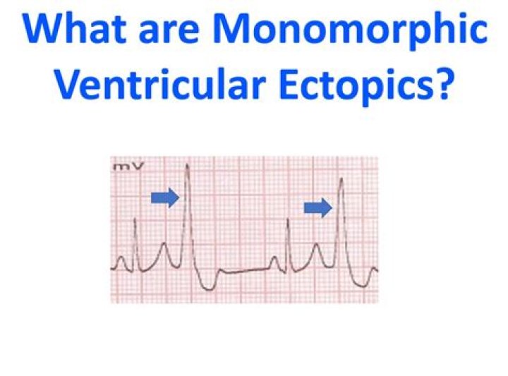 What are monomorphic papules?