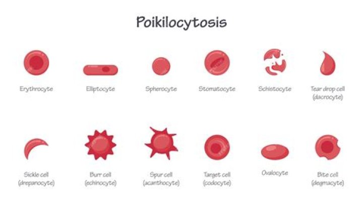 What are Poikilocytosis cells?