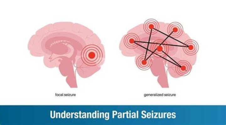 What are psychomotor seizures?